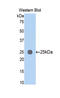 Myosin-6 antibody, LS-C295493, Lifespan Biosciences, Western Blot image 