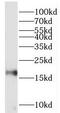 Peptidylprolyl Cis/Trans Isomerase, NIMA-Interacting 1 antibody, FNab06457, FineTest, Western Blot image 