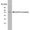 Cytochrome P450 Family 19 Subfamily A Member 1 antibody, MCA2077S, Bio-Rad (formerly AbD Serotec) , Immunohistochemistry paraffin image 