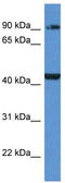 Alpha-Methylacyl-CoA Racemase antibody, TA343068, Origene, Western Blot image 