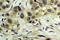 Nibrin antibody, A00732S343, Boster Biological Technology, Immunohistochemistry frozen image 