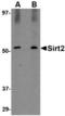 SIR2 antibody, TA306534, Origene, Western Blot image 