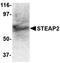 STEAP2 Metalloreductase antibody, orb74873, Biorbyt, Western Blot image 
