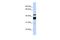 Ceramide Synthase 2 antibody, PA5-40572, Invitrogen Antibodies, Western Blot image 