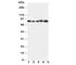 Integrin Subunit Beta 2 antibody, R30705, NSJ Bioreagents, Western Blot image 
