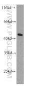 Eukaryotic initiation factor 4A-III antibody, 10463-1-AP, Proteintech Group, Western Blot image 