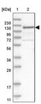 Zinc Finger CCCH-Type Containing 11A antibody, PA5-55309, Invitrogen Antibodies, Western Blot image 