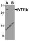Vesicle Transport Through Interaction With T-SNAREs 1B antibody, 8289, ProSci, Western Blot image 