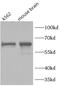 Lymphatic Vessel Endothelial Hyaluronan Receptor 1 antibody, FNab04911, FineTest, Western Blot image 