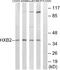Homeobox B2 antibody, A30723, Boster Biological Technology, Western Blot image 