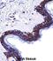 Desmoglein 1 antibody, abx028050, Abbexa, Immunohistochemistry frozen image 