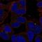 Solute Carrier Family 35 Member D3 antibody, NBP2-57003, Novus Biologicals, Immunofluorescence image 
