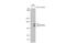 Neuraminidase antibody, GTX636956, GeneTex, Western Blot image 