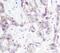 Junction Plakoglobin antibody, PA5-17320, Invitrogen Antibodies, Immunohistochemistry paraffin image 