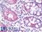 Solute Carrier Family 6 Member 7 antibody, LS-B9487, Lifespan Biosciences, Immunohistochemistry frozen image 