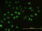 Ubiquitin Conjugating Enzyme E2 H antibody, LS-C198397, Lifespan Biosciences, Immunofluorescence image 