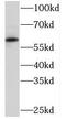 Pyruvate Kinase L/R antibody, FNab06490, FineTest, Western Blot image 