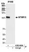 FANCD2 And FANCI Associated Nuclease 1 antibody, A302-660A, Bethyl Labs, Immunoprecipitation image 