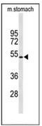 Potassium Voltage-Gated Channel Subfamily J Member 11 antibody, AP52309PU-N, Origene, Western Blot image 