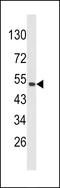 Pleckstrin homology domain-containing family O member 1 antibody, LS-C168797, Lifespan Biosciences, Western Blot image 