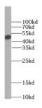 Galactosidase Alpha antibody, FNab00329, FineTest, Western Blot image 