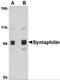 Syntaphilin antibody, 4635, ProSci, Western Blot image 