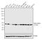Mitogen-Activated Protein Kinase Kinase 1 antibody, MA5-15162, Invitrogen Antibodies, Western Blot image 