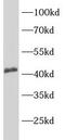 CD192 antibody, FNab10531, FineTest, Western Blot image 