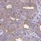 Zinc Finger Protein 696 antibody, HPA057855, Atlas Antibodies, Immunohistochemistry paraffin image 
