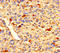 Zinc Finger Protein 384 antibody, A53949-100, Epigentek, Immunohistochemistry paraffin image 
