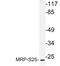 Mitochondrial Ribosomal Protein S25 antibody, LS-C177855, Lifespan Biosciences, Western Blot image 