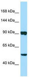 Papilin, Proteoglycan Like Sulfated Glycoprotein antibody, TA331345, Origene, Western Blot image 