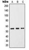 Cytochrome P450 Family 2 Subfamily C Member 9 antibody, LS-C352087, Lifespan Biosciences, Western Blot image 