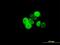 Progesterone Receptor antibody, H00005241-M07, Novus Biologicals, Immunofluorescence image 