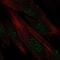 Disrupted In Renal Carcinoma 1 antibody, NBP2-68870, Novus Biologicals, Immunocytochemistry image 