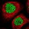 Aprataxin And PNKP Like Factor antibody, HPA034642, Atlas Antibodies, Immunocytochemistry image 