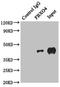 F-Box Protein 4 antibody, LS-C682115, Lifespan Biosciences, Immunoprecipitation image 