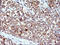 Hydroxysteroid 17-Beta Dehydrogenase 4 antibody, M02923, Boster Biological Technology, Immunohistochemistry paraffin image 