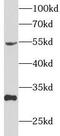 Tissue Factor Pathway Inhibitor antibody, FNab08634, FineTest, Western Blot image 
