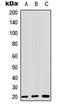 Zinc Finger Protein 695 antibody, LS-C368558, Lifespan Biosciences, Western Blot image 