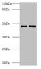 Eukaryotic Translation Initiation Factor 4A2 antibody, A52667-100, Epigentek, Western Blot image 