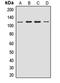 ArfGAP With Coiled-Coil, Ankyrin Repeat And PH Domains 2 antibody, LS-C667879, Lifespan Biosciences, Western Blot image 