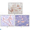 FPS antibody, LS-C812470, Lifespan Biosciences, Immunohistochemistry paraffin image 