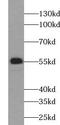 UDP Glucuronosyltransferase Family 2 Member B4 antibody, FNab09240, FineTest, Western Blot image 