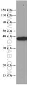 Translocase Of Outer Mitochondrial Membrane 40 antibody, 66658-1-Ig, Proteintech Group, Western Blot image 