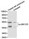 Mitogen-Activated Protein Kinase 8 antibody, TA327585, Origene, Western Blot image 