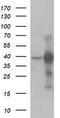 Uracil Phosphoribosyltransferase Homolog antibody, M09616, Boster Biological Technology, Western Blot image 