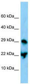 Cyclic AMP-dependent transcription factor ATF-3 antibody, TA329230, Origene, Western Blot image 