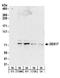 DEAD-Box Helicase 17 antibody, A300-509A, Bethyl Labs, Western Blot image 
