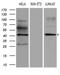 Elongator Acetyltransferase Complex Subunit 4 antibody, LS-C791928, Lifespan Biosciences, Western Blot image 